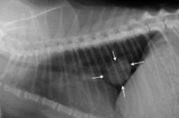 Cancer du poumon : détecter les signes précoces avec un test sanguin 