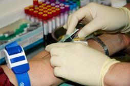 Cancer de la prostate : le dépistage ne repose pas sur le PSA 