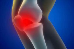 Arthrose du genou : un verre de lait par jour ralentit la progression
