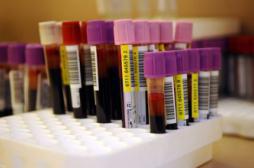 Cancers du sang : l'ibrutinib, un espoir pour des centaines de malades 
