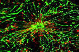 Parkinson : un espoir grâce aux cellules souches