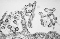 États-Unis : un Hantavirus a déjà tué 3 personnes