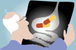 Flore intestinale : des chercheurs découvrent des bactéries inconnues