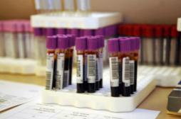 Dépister 13 types de cancer avec un test sanguin