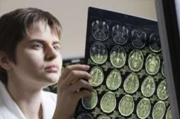 Parkinson, sclérose en plaques : des idées reçues et fausses