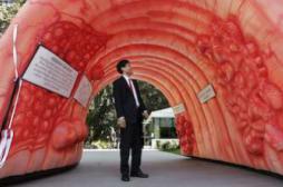 Cancer colorectal : la maladie progresse chez les jeunes 