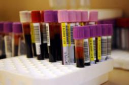 Cancer : une analyse de sang plutôt qu’une ponction