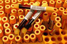 Hépatite C : la guérison totale à portée de main