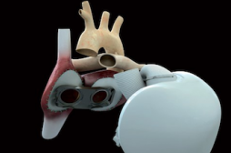 Cœur artificiel : comment réagit la communauté médicale