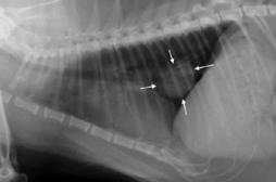 Cancer du poumon : le test sanguin, une avancée majeure ? 