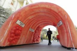 Cancer colorectal : des tests de dépistage plus efficaces bientôt disponibles