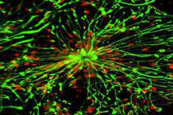 Des chercheurs restaurent la production de nouveaux neurones