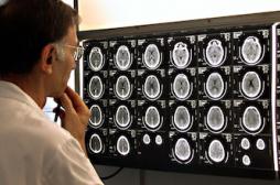 Une Semaine du cerveau pour percer ses mystères