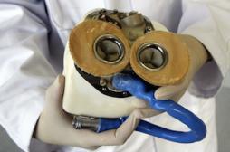 Coeur artificiel : un deuxième patient implanté dans le plus grand secret