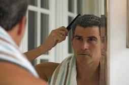 Calvitie: les hommes prêts à tout pour l'éviter 