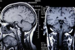 Des histoires d’êtres aimés pour sortir plus vite du coma