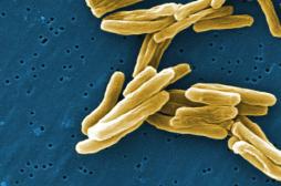 Une nouvel antibiotique efficace contre les bactéries multirésistantes