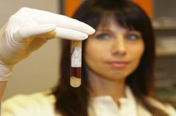 Trisomie 21 : les tests sanguins plus performants que l'amniocentèse 