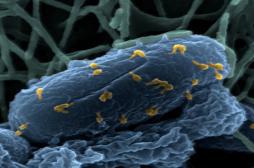 Des virus contre la mucoviscidose