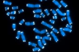 Chromosome Y : la clé de la plus faible espérance de vie des hommes