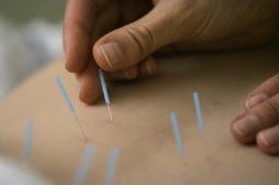 Cancer du sein : l'acupuncture réduit les bouffées de chaleur 