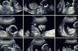 Développement du squelette : pourquoi les mouvements du foetus dans l'utérus sont importants