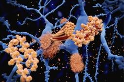 Les infections virales pourraient favoriser les maladies neurodégénératives 