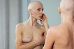 Cancer du sein : comment la mastectomie impacte la santé sexuelle et la qualité de vie