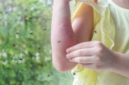 Pourquoi certains attirent-ils davantage les moustiques ?