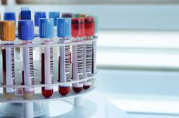 Vieillissement : un test sanguin pour prédire l’état de santé