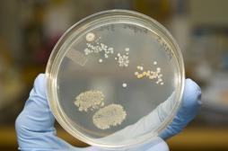 Italie :  découverte d'une super-bactérie résistante à tous les antibiotiques 