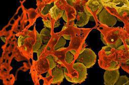 Antibiorésistance : des plans nationaux annoncés par les Etats