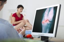 Arthrose du genou : l'acide hyaluronique n'est plus remboursé 