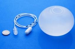 Obésité : résultats prometteurs pour un ballon gastrique
