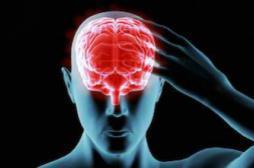 Migraine : un traitement  par radiologie efficace