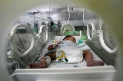 CHU d'Angers : Ayana décède 2 semaines après son extubation