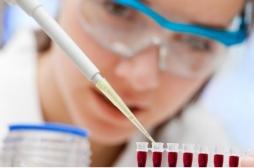 Cancer de la peau : des chercheurs mettent au point un test sanguin pour détecter le mélanome