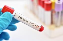 Covid-19 : des entreprises se lancent dans la course au test sérologique