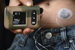 Pancréas artificiel : un patient français autonome pendant 3 mois