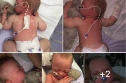 Son bébé de 5 mois attrape la rougeole, elle accuse les anti-vaccins