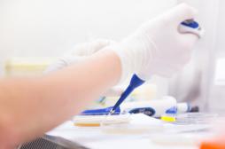 Des chercheurs créent un estomac  en laboratoire 