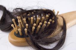Alopécie : les perruques mieux remboursées pour les malades