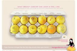 Cancer du sein : repérer les signes grâce aux citrons 