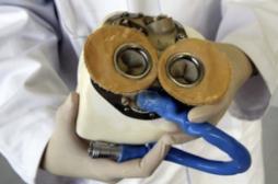 Cœur artificiel : Carmat reprend les essais sur 20 patients