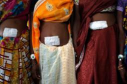 Stérilisations en Inde : des conditions d’hygiène déplorables 