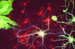 Vieillissement : les neurones ne meurent pas   