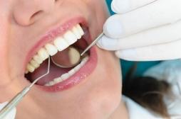 Santé bucco-dentaire : la parodontite augmente le risque d’hypertension 