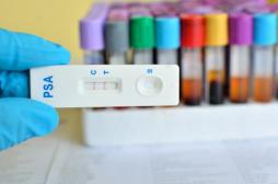 Cancer de la prostate : à qui s'adresse le dépistage