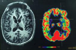 Des chercheurs réussissent à contrôler l’activité des cellules du cerveau