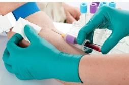 Des scientifiques créent un test sanguin pour déterminer l’espérance de vie de chacun